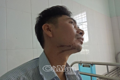 Dùng điện giết người không thành
