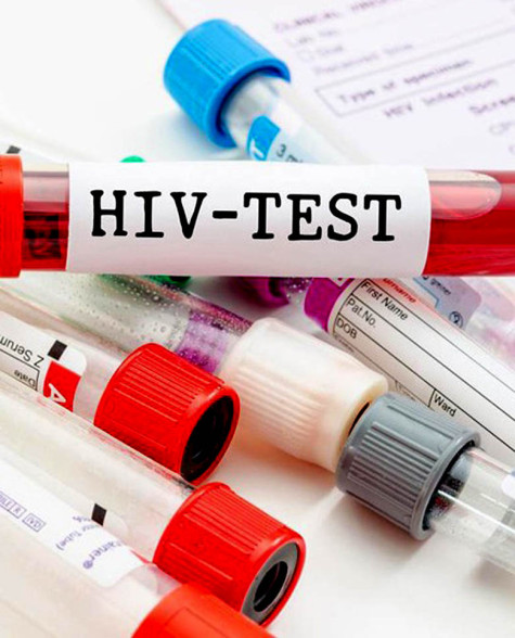 Một số điểm mới trong Luật Phòng, chống nhiễm vi-rút HIV/AIDS