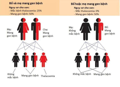 13% dân số Việt Nam mang gene bệnh tan máu bẩm sinh