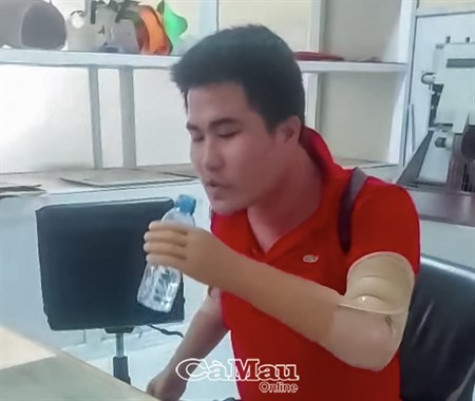 Anh Huỳnh Hữu Tình được lắp thêm tay giả