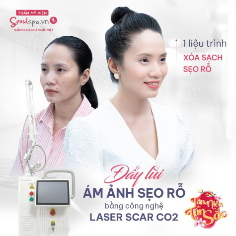 Thẩm mỹ viện SeoulSpa.Vn - Địa chỉ trị sẹo rỗ uy tín