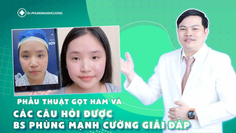 Phẫu Thuật Gọt Hàm Và Các Câu Hỏi Được BS Phùng Mạnh Cường Giải Đáp