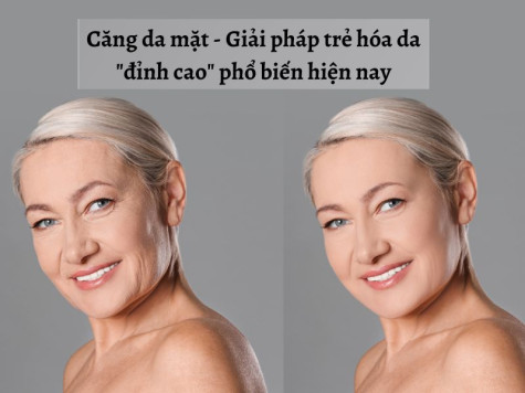 Căng da mặt - Giải pháp trẻ hóa da "đỉnh cao" phổ biến hiện nay