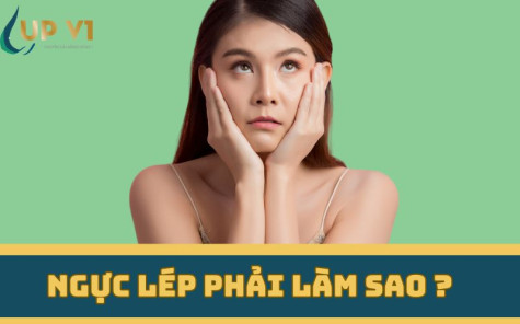 BÍ QUYẾT NÂNG CẤP VÒNG 1