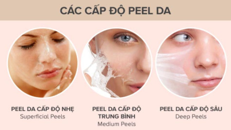 Peel da và những lưu ý mà Ngân Thị - CEO thương hiệu Sooyoung nhắc bạn phải biết