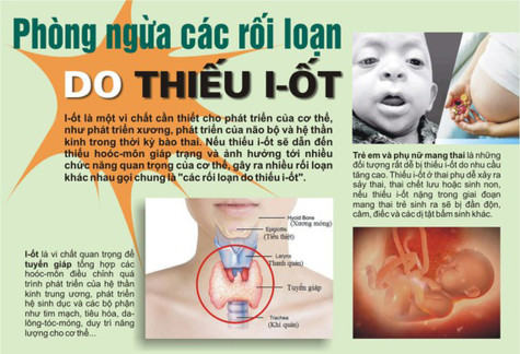 Phòng, chống các rối loạn do thiếu i-ốt