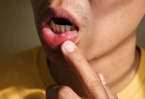 Các dấu hiệu cảnh báo đường ruột chứa đầy độc tố