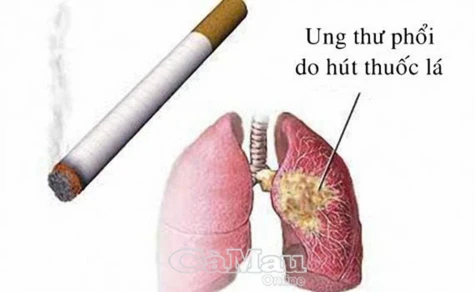 Không có sản phẩm thuốc lá nào an toàn cho sức khoẻ