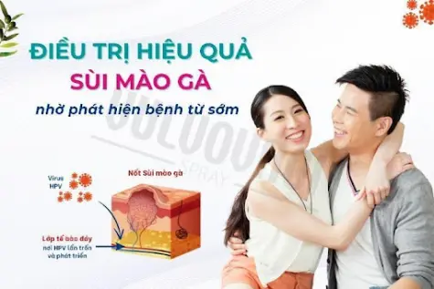 Giải pháp mới trong xử lý sùi mào gà: tận gốc, an toàn, hiệu quả