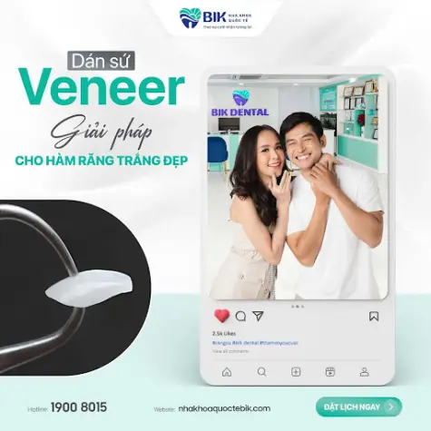 Tìm hiểu dán sứ Veneer tại Nha Khoa Quốc Tế BIK