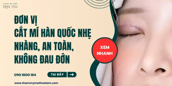 Trương Thế Khang chia sẻ những điều cần biết trước khi cắt mí